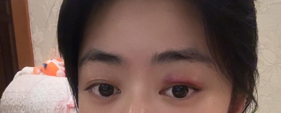 秀儿